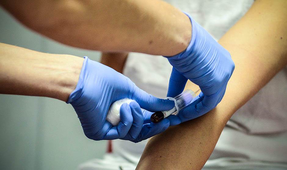  Test krvi otkriva rak kože u ranoj fazi 