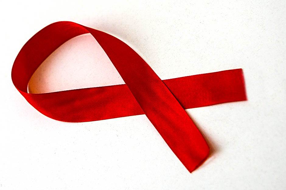  HIV/AIDS besplatno testiranje u Banjaluci 