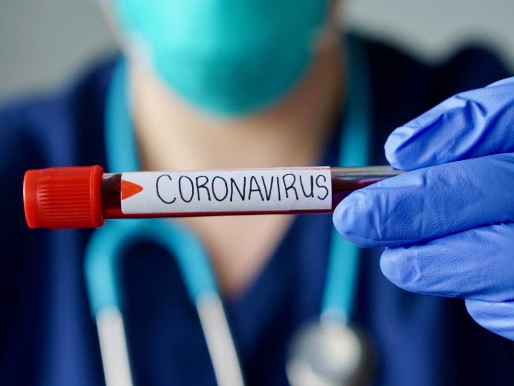  Još pet zaraženih koronavirusom u Republici Srpskoj 