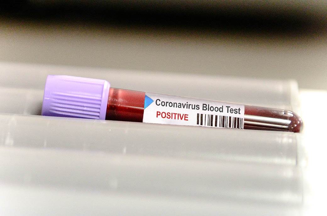  Istraživanje: Da li je koronavirus "pobjegao" iz nečije laboratorije? 