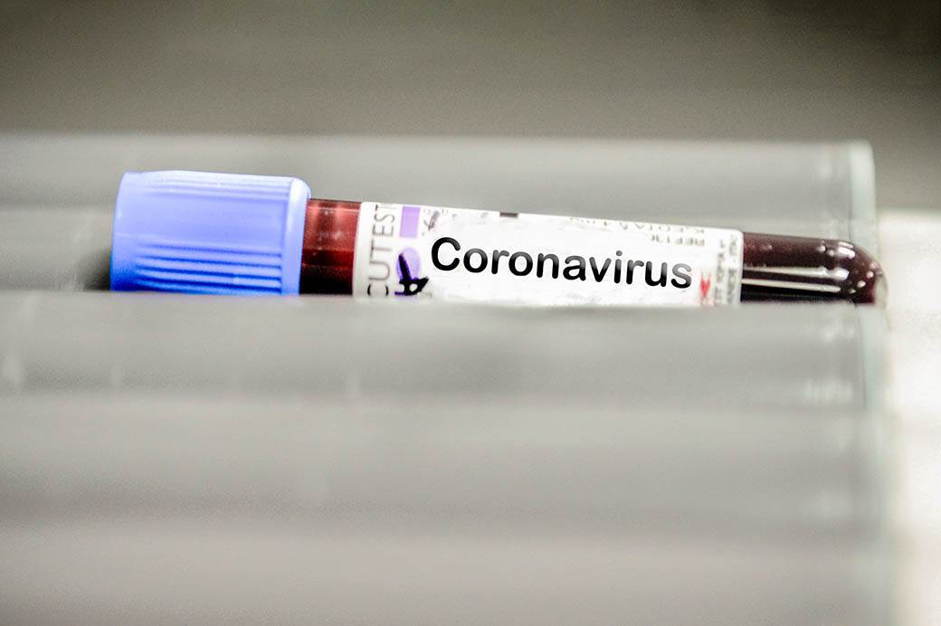  Migranti privedeni u Sloveniji ipak nemaju koronavirus 