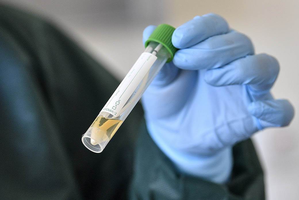  Potvrđen prvi slučaj koronavirusa u Brezi 