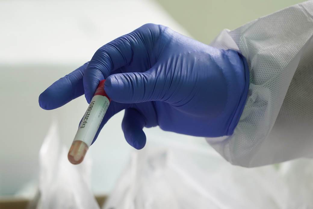  Prvi slučajevi koronavirusa u Kaknju, zaražene tri osobe 