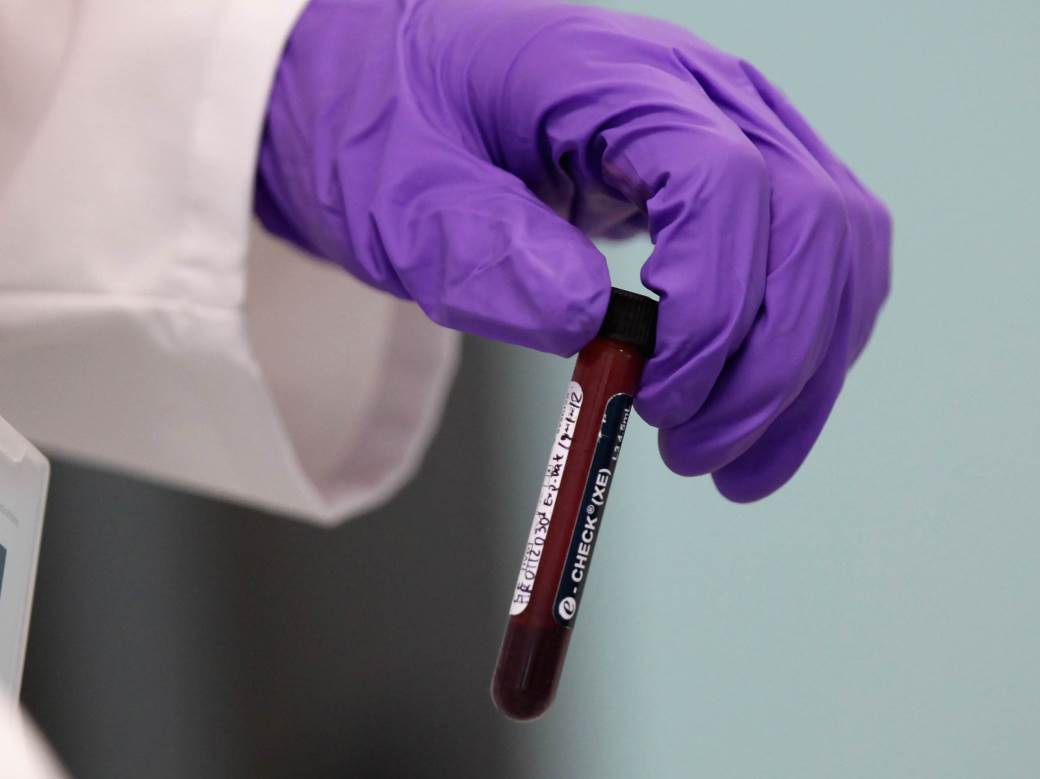  Šta znači lažno pozitivan na korona virus 