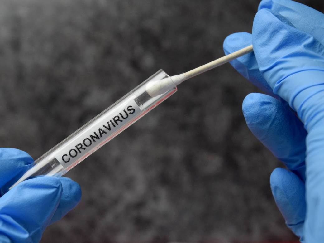  Negativan PCR test na koronavirus lažni test 