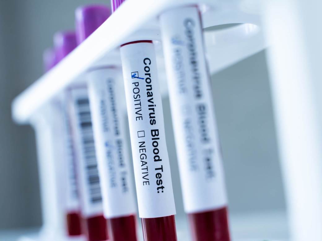  Do kraja sedmice u BiH stiže 60.000 PCR testova 