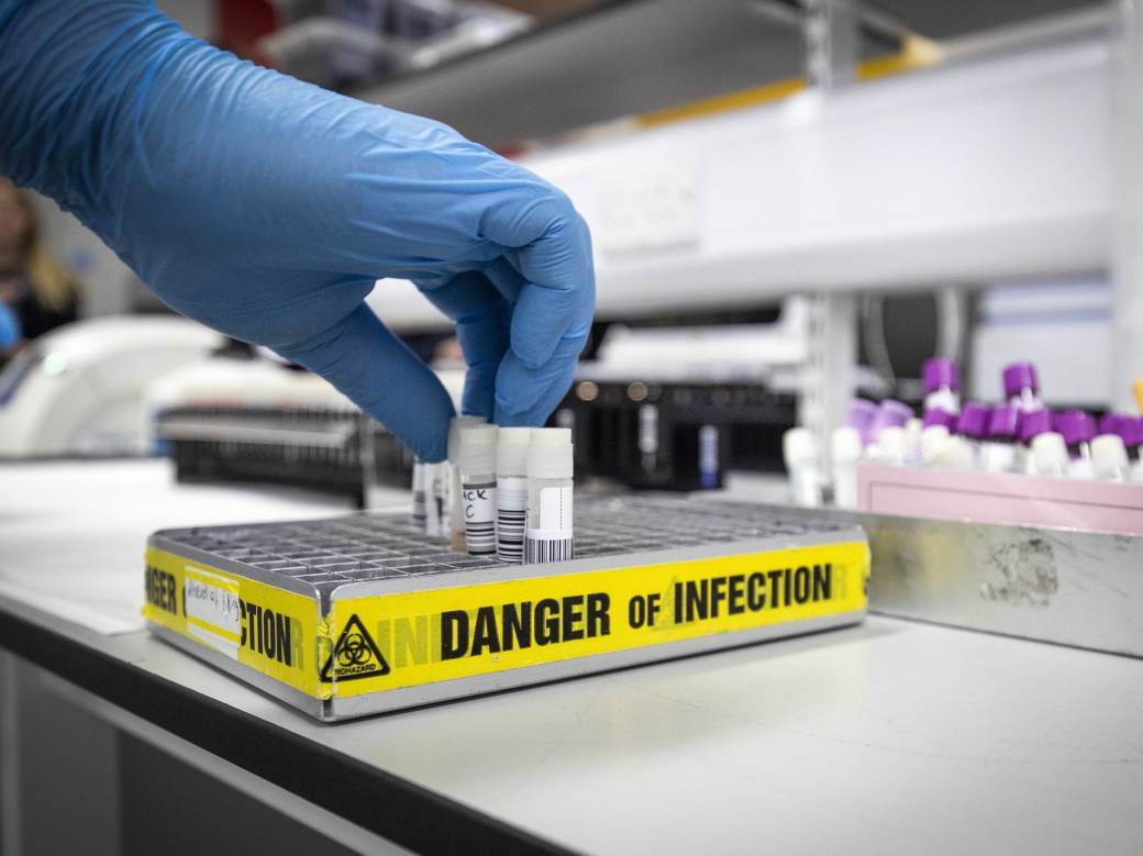  Interpol: Zaplijenjeno 17.000 lažnih testova za korona virus! 