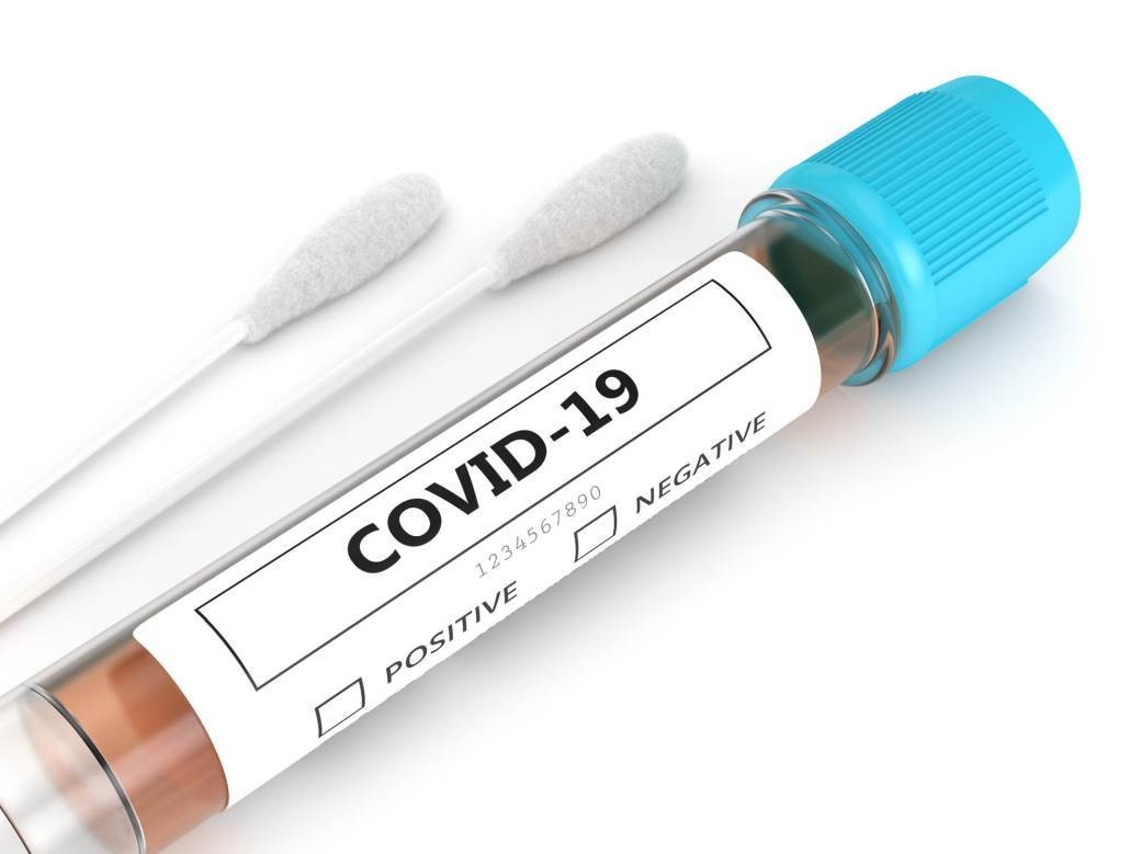  koronavirus zaraza FBiH COVID 19 