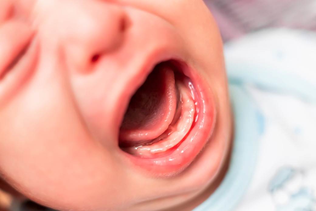  Dvije tek rođene bebe u Beogradu pozitivne na korona virus 