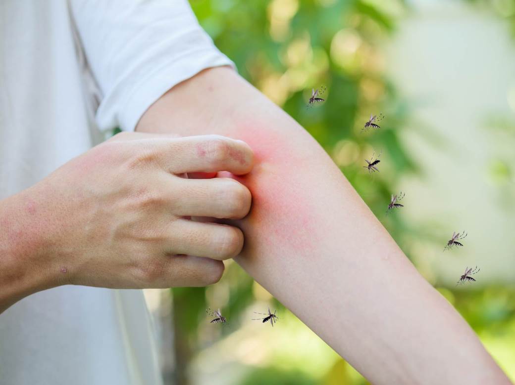  kako spriječiti svrab od ujeda komarca 