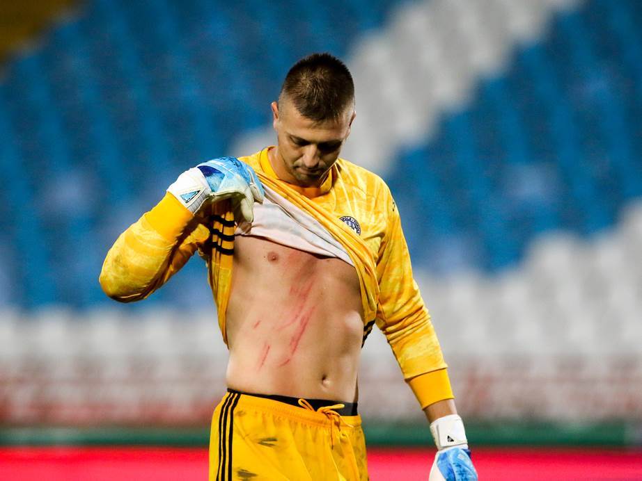  Filipović pokazao povredu: Boaći kramponima ostavio ožiljak golmanu TSC-a! 