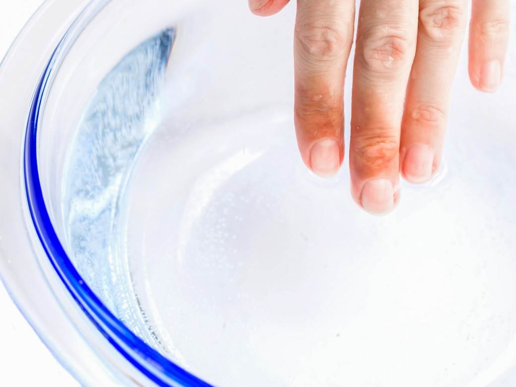  Potopite ruke u hladnu vodu: Najjednostavniji test koji mnogo otkriva o zdravlju srca! 