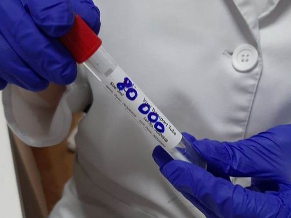  Na Graničnom prelazu kod Bijeljine otkriveno sedam falsifikovanih PCR testova 