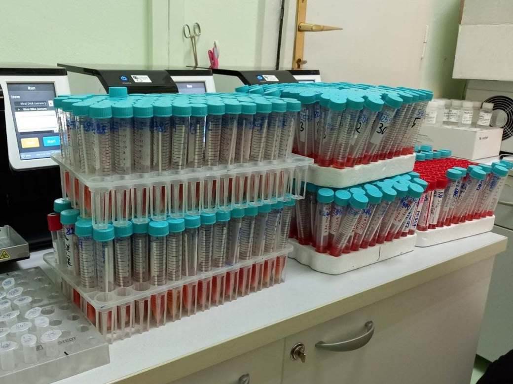  Britanija: Naučnici pozvali da se prekine masovno testiranje na koronavirus 