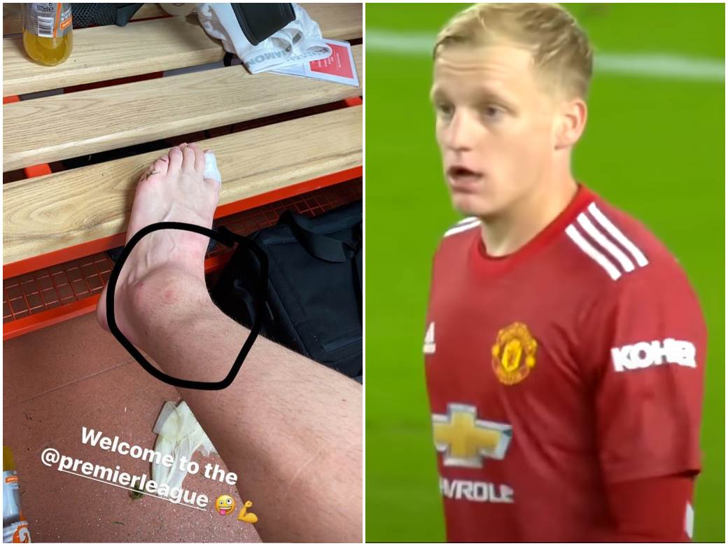  Doni Van de Bek - povreda zgloba odbrana Premijer liga 