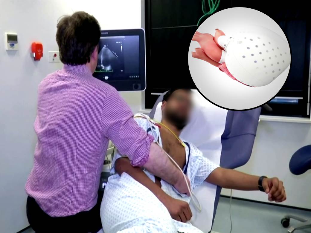  Vještačko srce uskoro u prodaji, radiće na baterije: EU dala zeleno svjetlo, poznata i cijena! (VIDEO) 