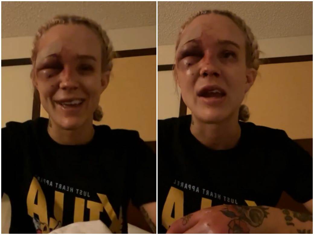  (UZNEMIRUJUĆE) Najkrvavija ženska borba svih vremena: Potresni prizori, potpuno su unakažene! (VIDEO) 