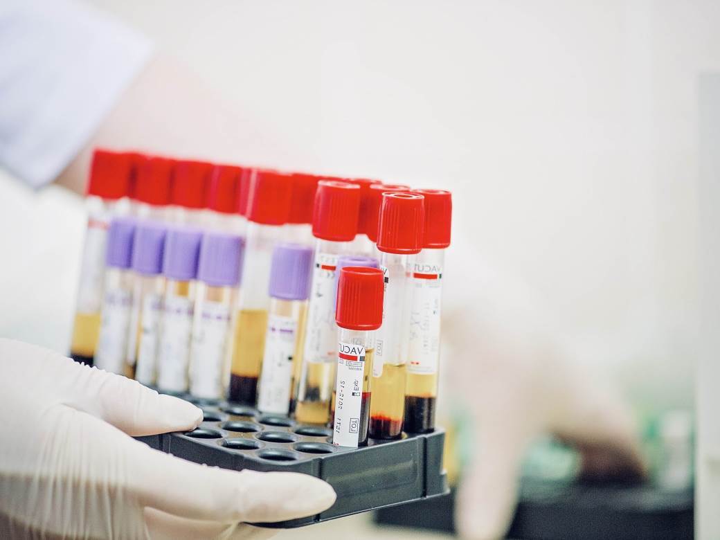  koronavirus vakcinacija Srbija vakcine 
