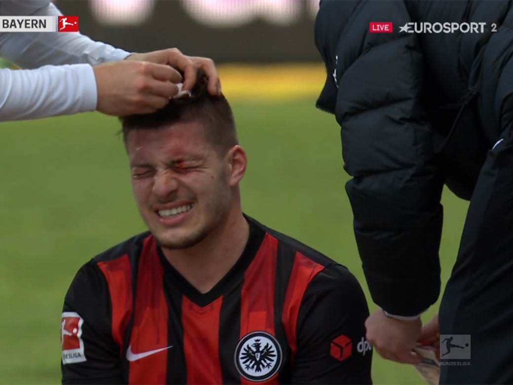  Luka Jović krvave glave napustio teren: Njemački reprezentativac "ostavio" zube na Lukinoj glavi! 
