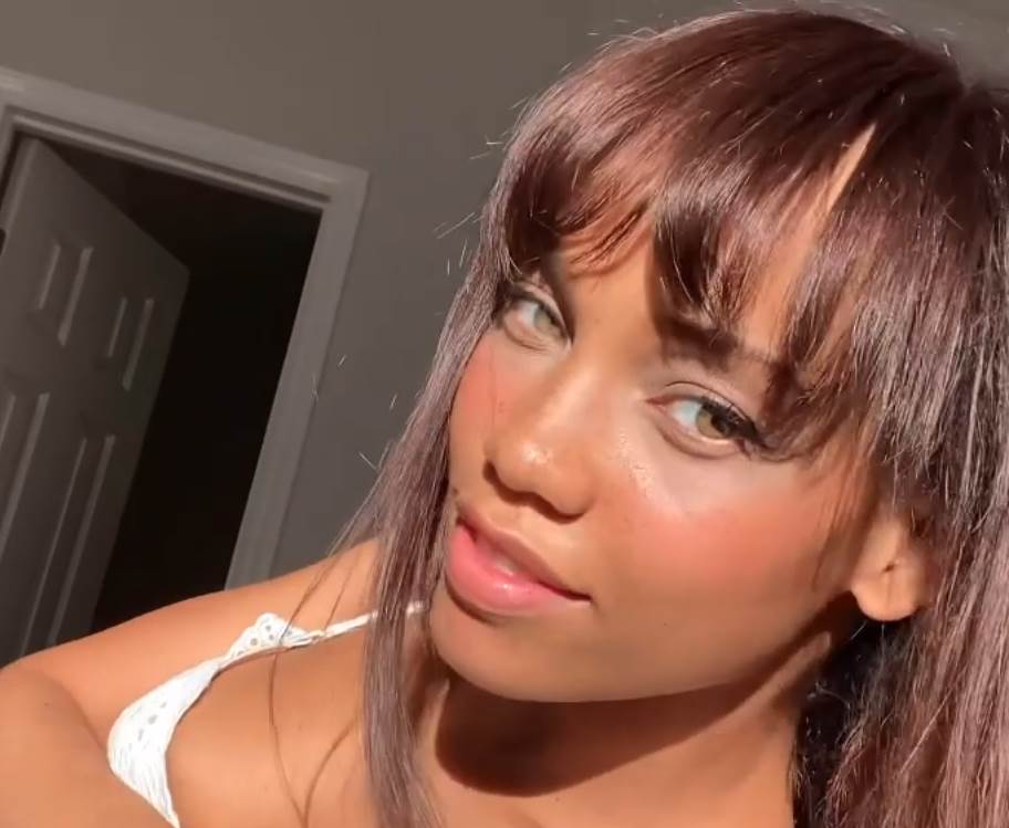  Manekenka se pohvalila operacijom, a ljudi se pitaju - šta joj je ovo trebalo?! 