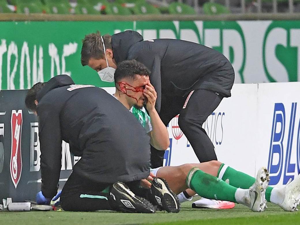  milos-veljkovic-verder-majnc-povreda-slomljen-nos-foto 