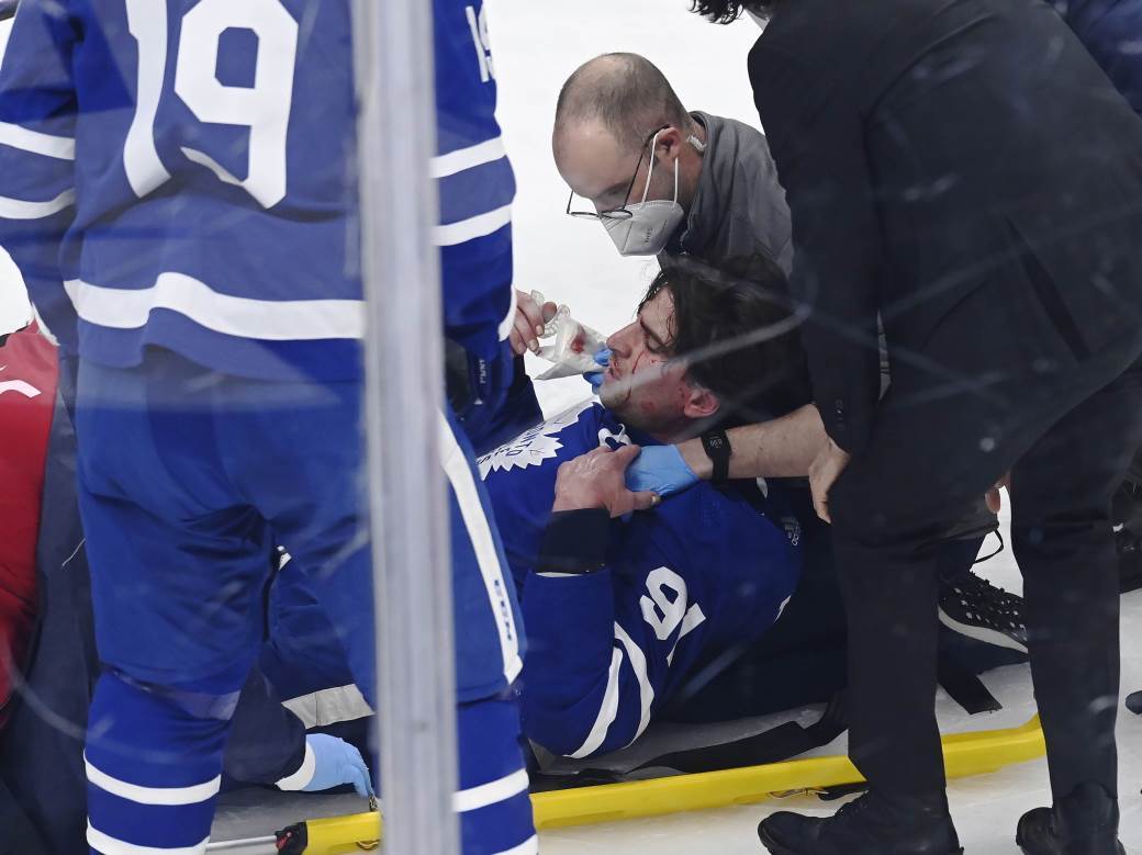  povreda hokejaša džon tavares 