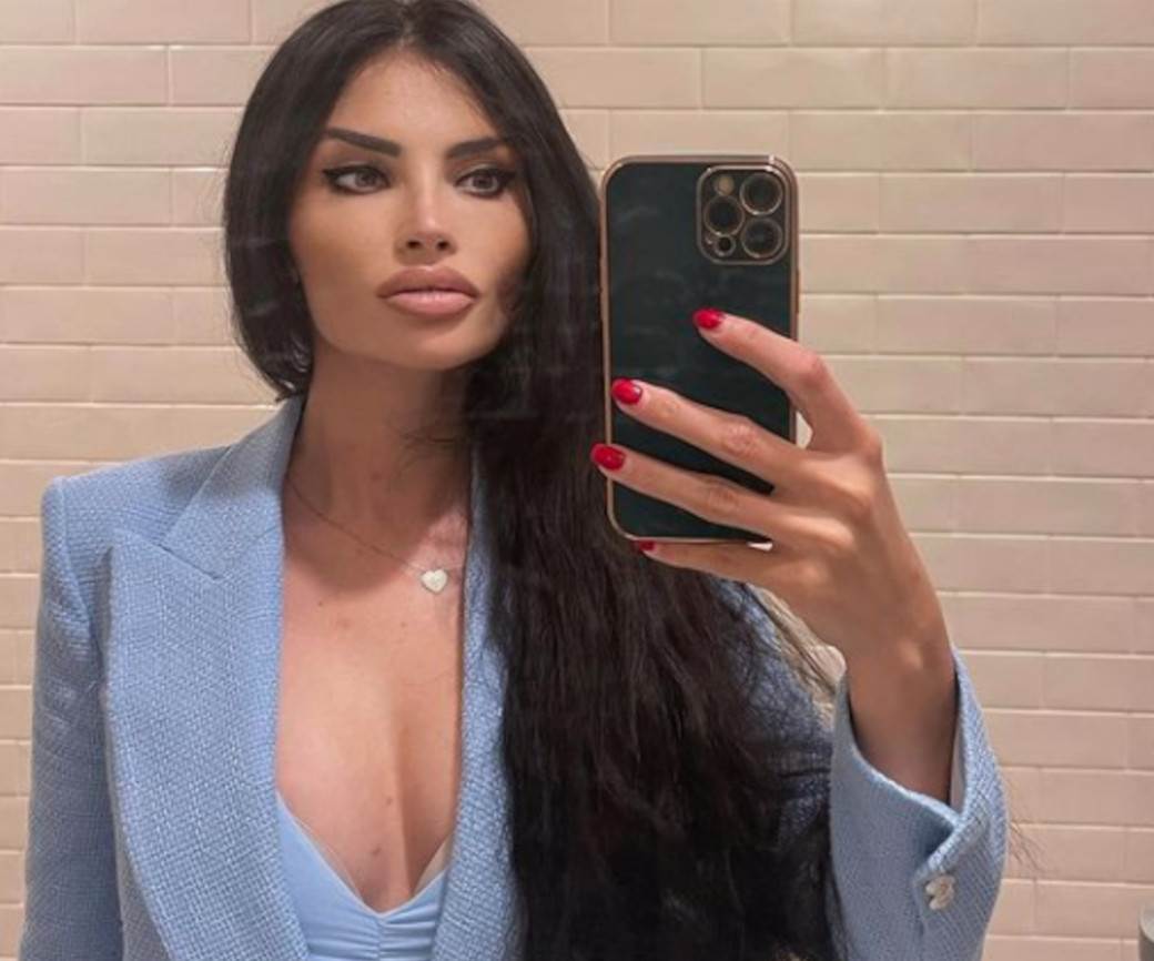  "Sestra mi je išla na 'vampirski tretman', ogorčena je..." 