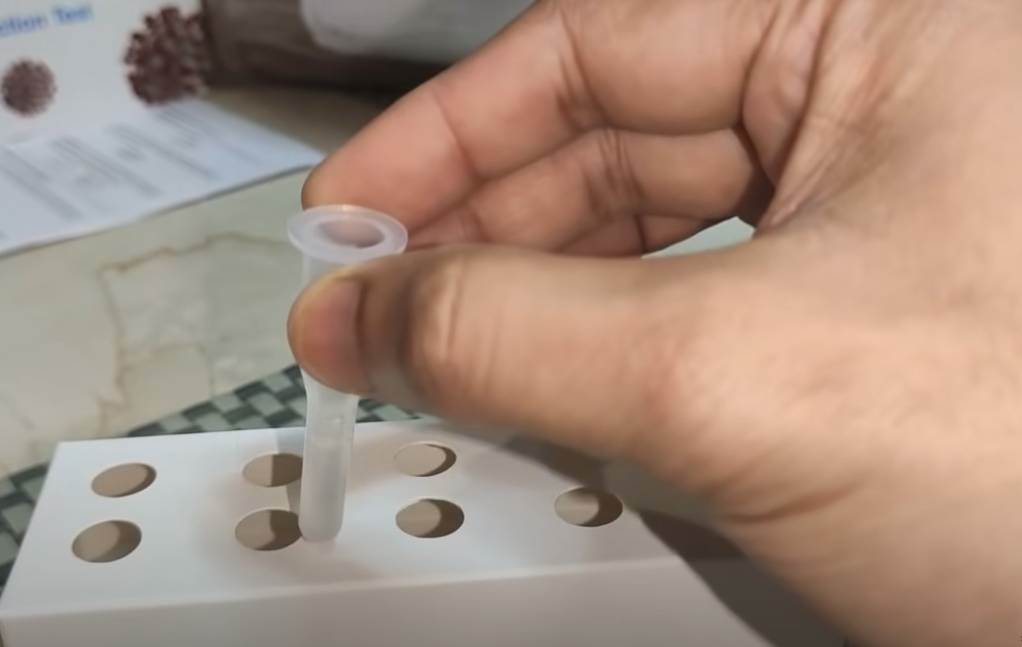  Tinejdžeri "provalili" kako se dobija lažno pozitivan test na koronavirus 