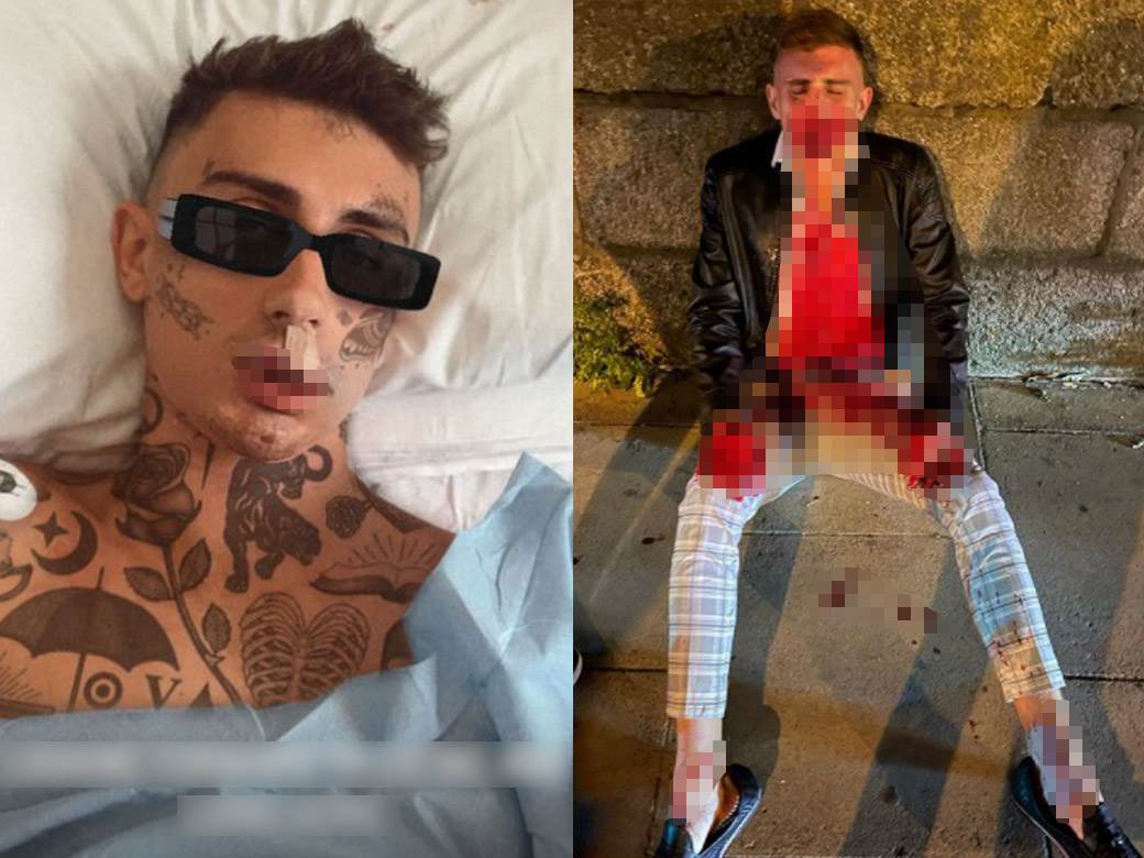  pretučen irski olimpijac džek vuli 