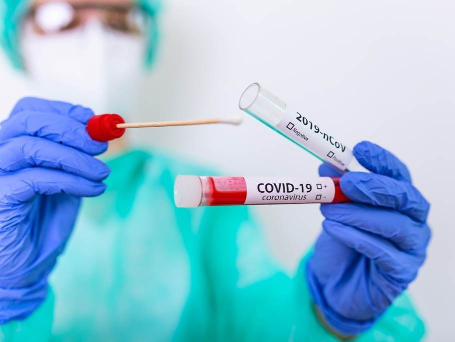 Epidemiološka situacija u BiH  
