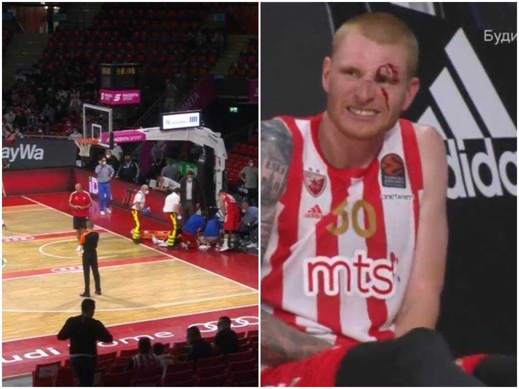 kk crvena zvezda teška povreda eron vajt 