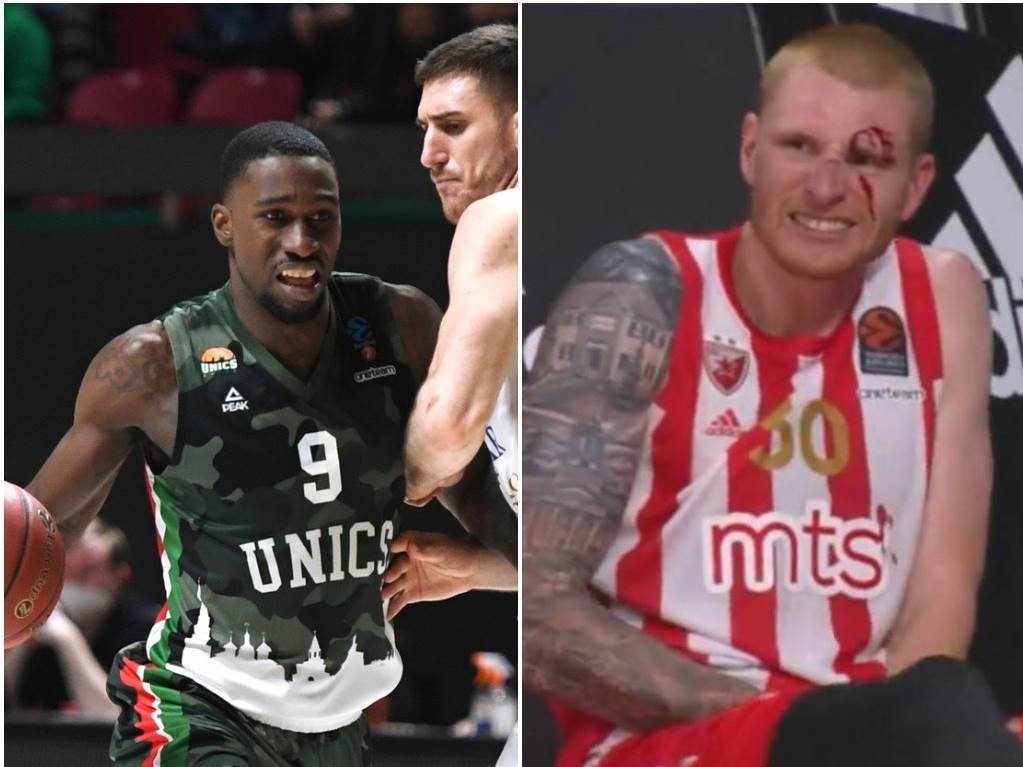  Okaro-Vajt-o-povredi-Erona-Vajta-kosarkasa-Zvezde 