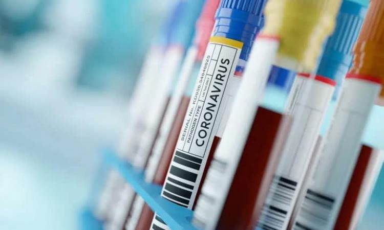  Epidemiološka situacija u Srpskoj 