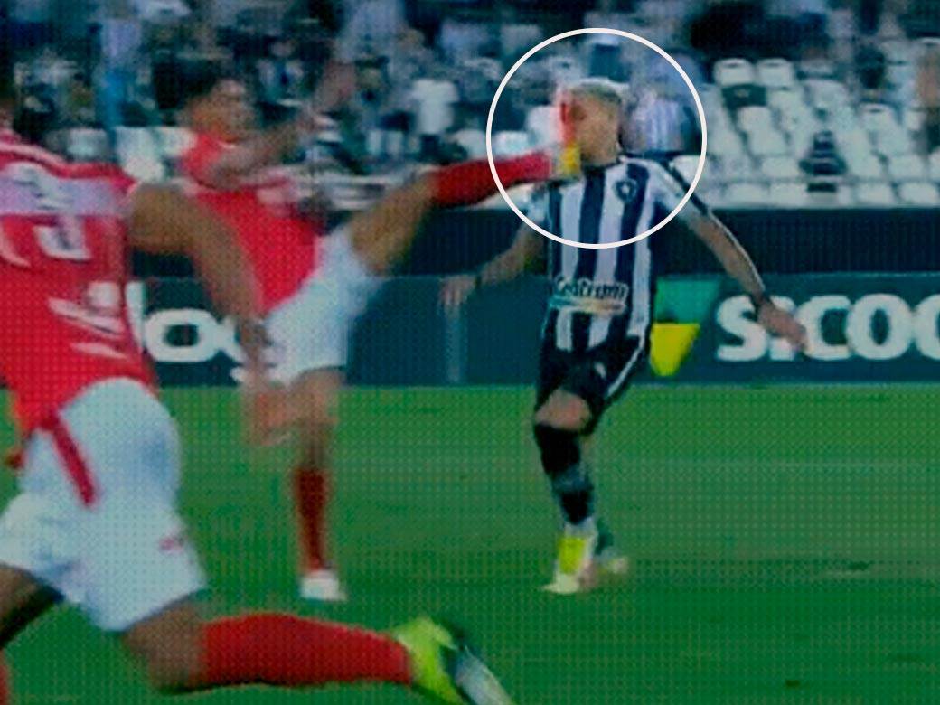  povreda fudbalera u brazilu 