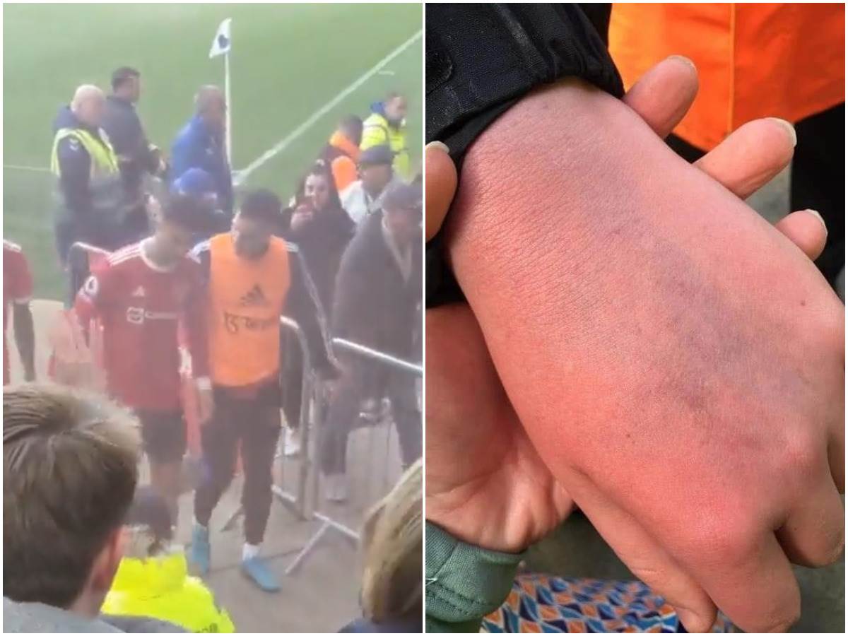  Kristijano Ronaldo udario dječaka koji ima autizam 