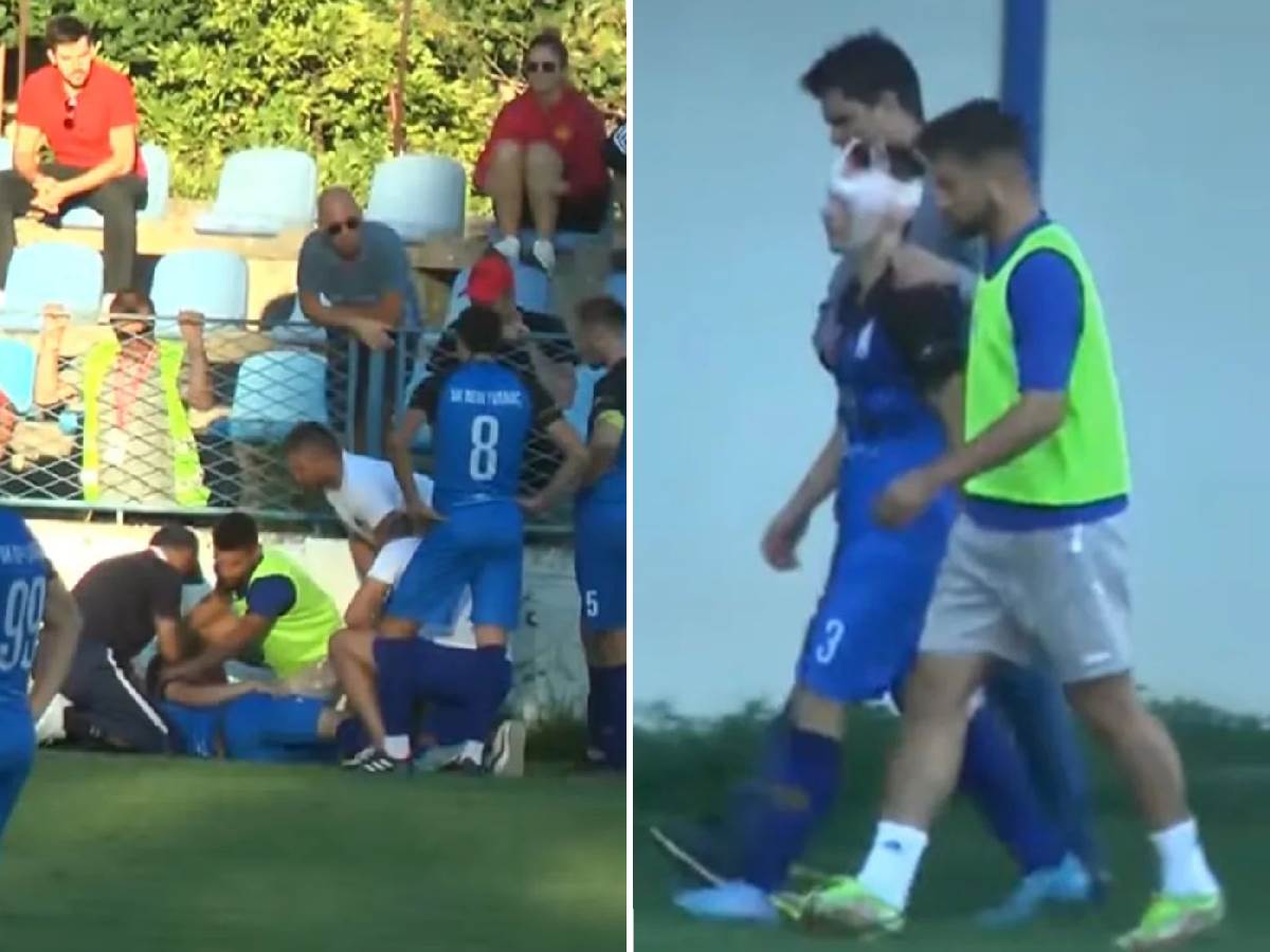  Hrvatski-fudbaler-udario-glavom-u-zid-tokom-utakmice 