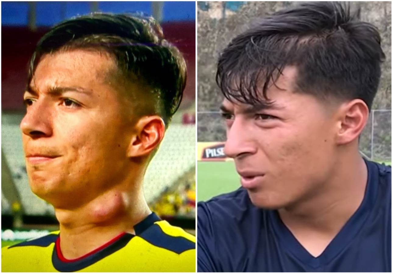  fudbaler ekvadora propušta mundijal zbog izbočine na vratu 