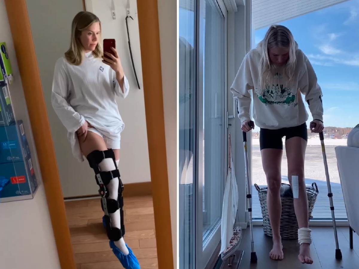  Švedska skijašica Lisa Hornblad se plaši amputacije noge 