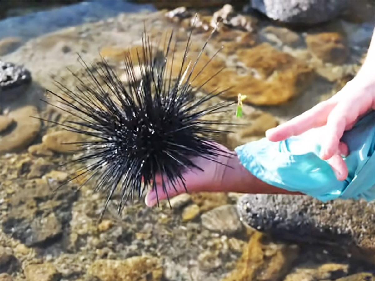  Kako izvaditi bodlje morskog ježa 