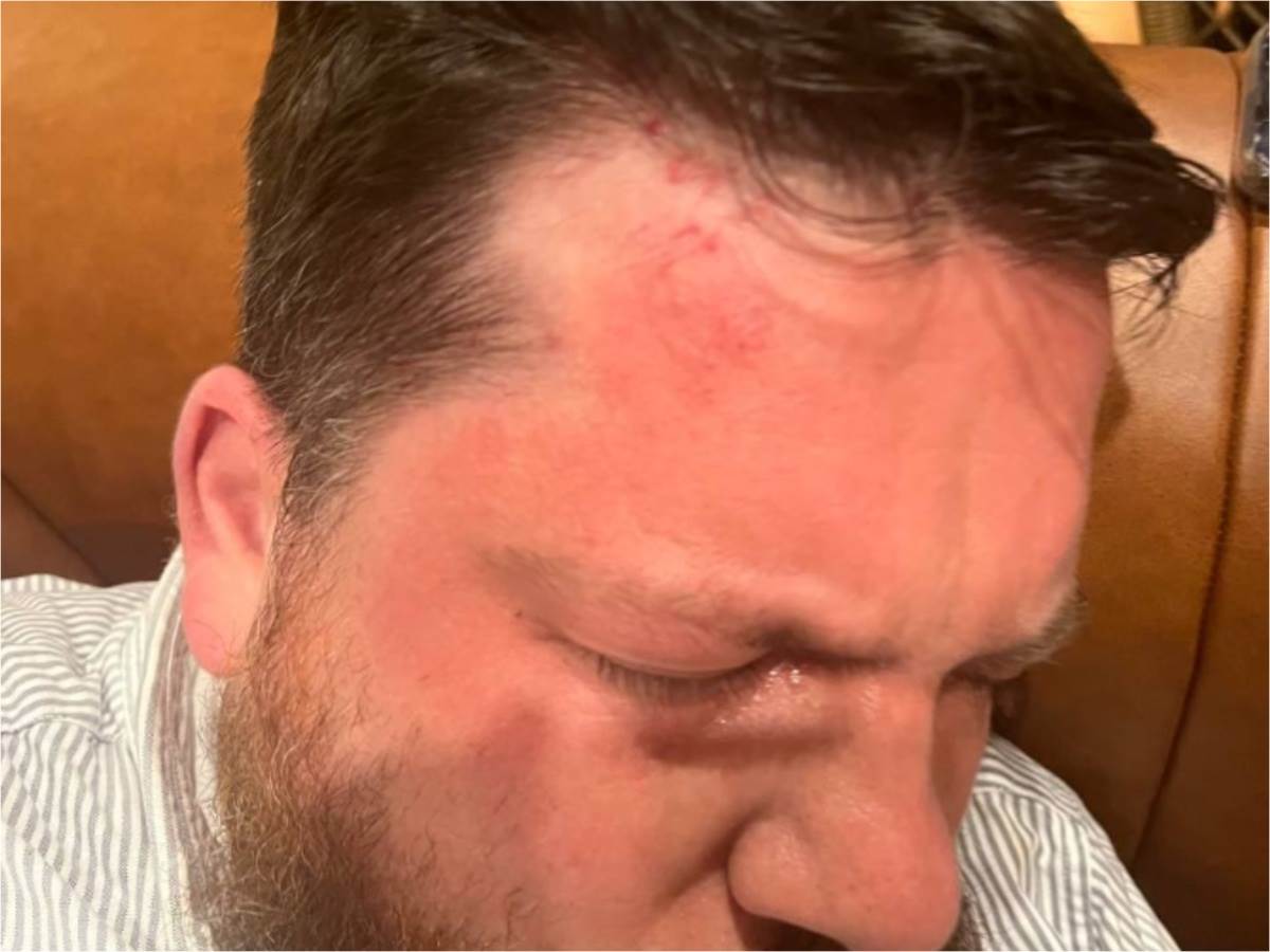 Bivši pomoćnik Navaljnog napadnut čekićem u Viljnusu 