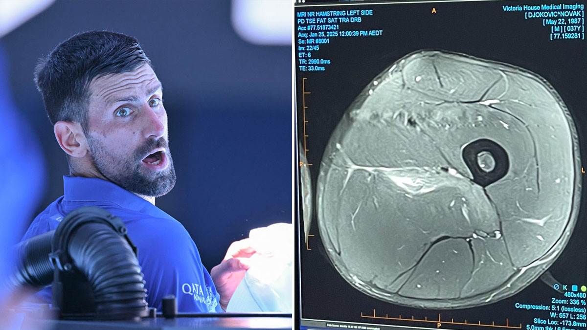 Francuski doktor o povredi Novaka Đokovića Francuski doktor o povredi Novaka Đokovića