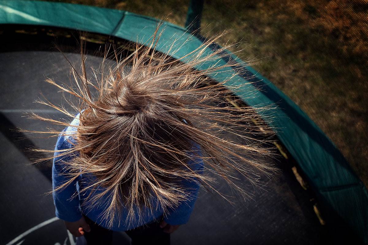  Zašto nas pecka elektricitet 