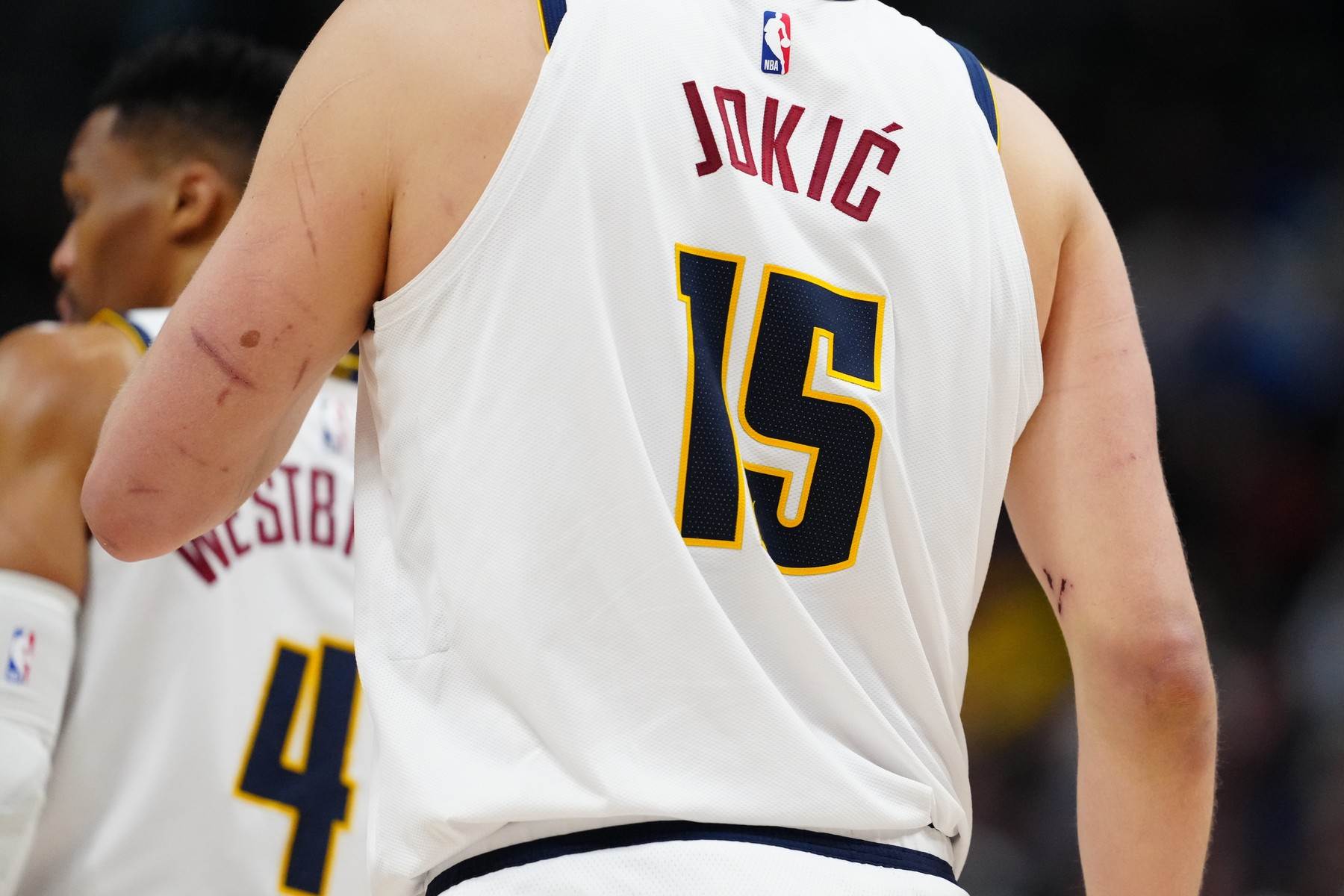  Nikola Jokić ima ogrebotine po rukama  