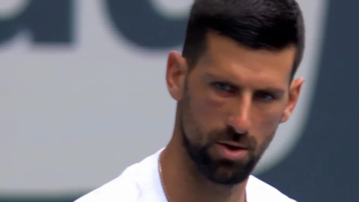 Novak Đoković ima podliv ispod oka Novak Đoković ima podliv ispod oka