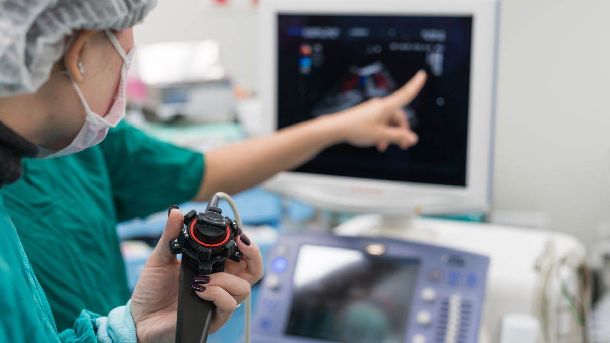  Šta određuje očekivani životni vijek 