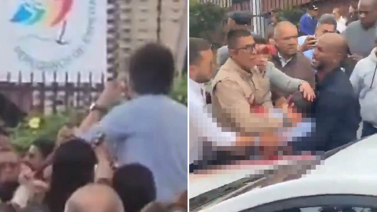  Predsjednički kandidat u Kolumbiji upucan na skupu 