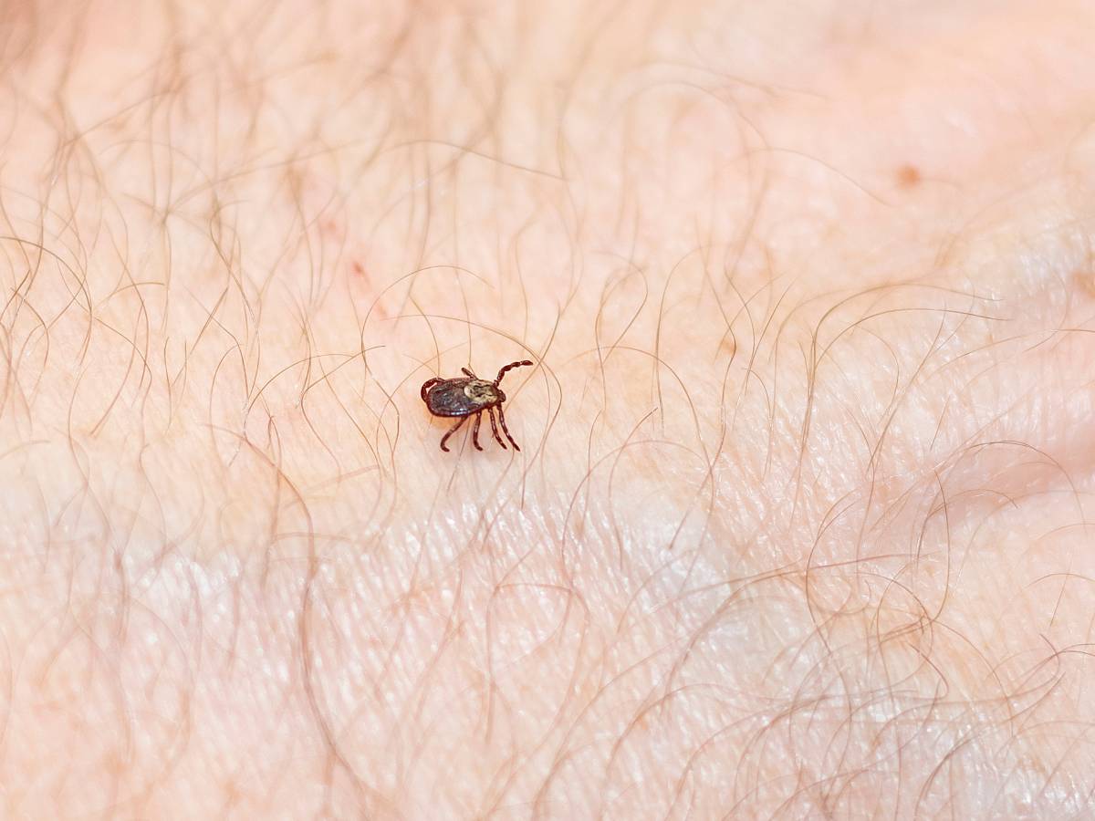  Grčka izdala upozorenje nakon što je muškarac preminuo od rijetke bolesti koju prenose krpelji 