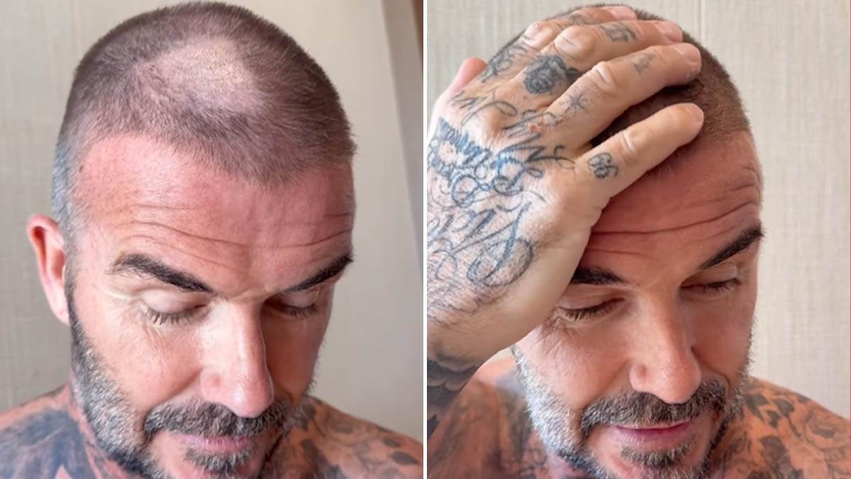  Bekam se sam šiša mašinicom 