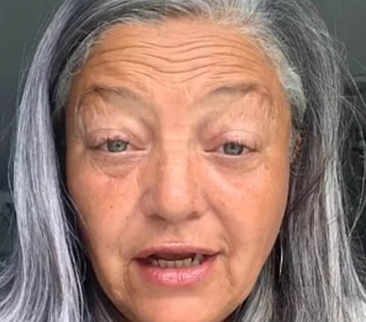  Žena (55) Prestala da puši, uštedjela 12.000 evra i otišla na operaciju lica: Rezultati su nevjerovatni 