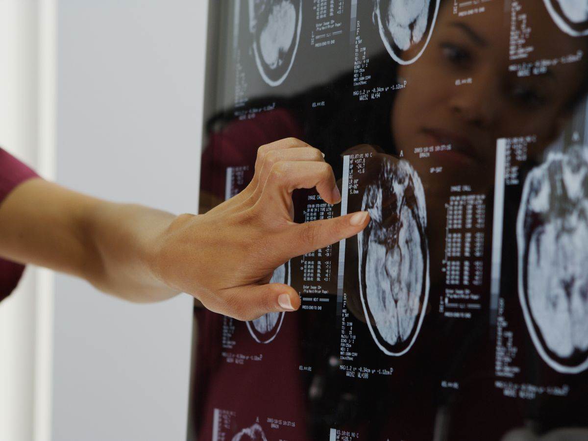  kad počinjemo ubrzano da starimo 